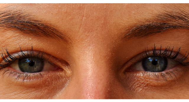 The Clear View: Is it Dry Eye Disease or Allergies? 